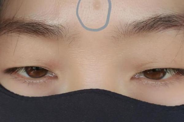 男人有观音痣的人命怎么样 男人有观音痣的人命解析